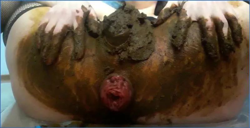 Scatlina viser anal prolaps midt i eget scat - scat video